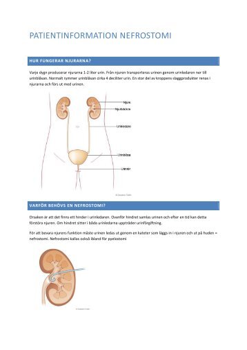 nefrostomikateter procedure nefrostomikateter procedure